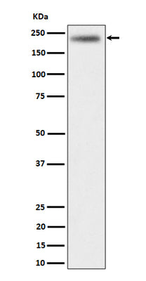 Anti-DENN Rabbit Monoclonal Antibody Boster Bio