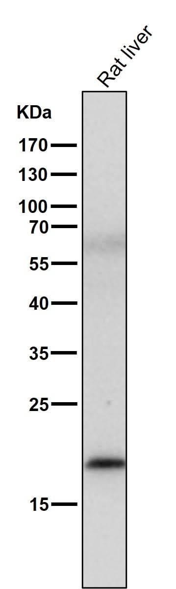 Anti-MLANA/Mart 1 Rabbit Monoclonal Antibody Boster Bio