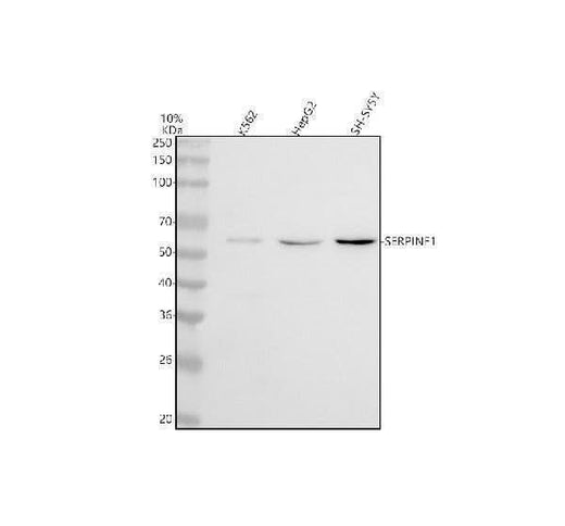 Anti-PEDF Monoclonal Antibody Boster Bio