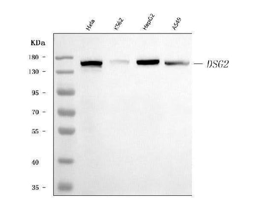 Anti-Desmoglein 2/DSG2 Antibody Picoband® (monoclonal, 2B4D1 Boster Bio