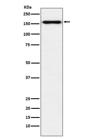 Anti-Desmoglein 2 Monoclonal Antibody Boster Bio