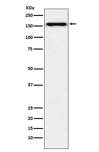 Anti-Desmoglein 2 Monoclonal Antibody Boster Bio
