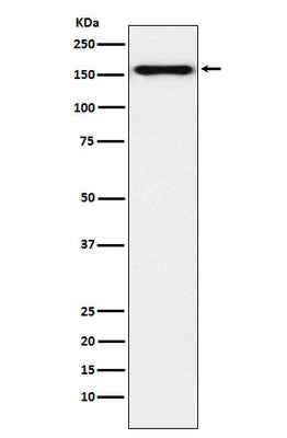 Anti-Desmoglein 2 Monoclonal Antibody Boster Bio