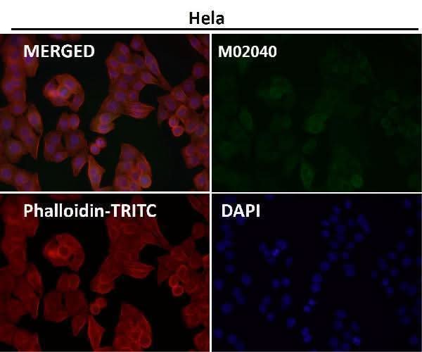 Anti-Cyclin B2 CCNB2 Rabbit Monoclonal Antibody Boster Bio