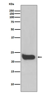 Anti-Interferon beta Rabbit Monoclonal Antibody Boster Bio