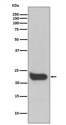 Anti-Interferon beta Rabbit Monoclonal Antibody Boster Bio