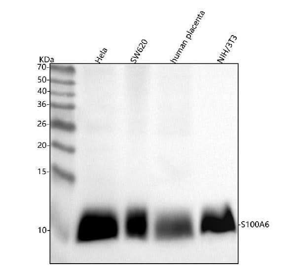 Anti-S100 alpha 6 S100A6 Rabbit Monoclonal Antibody Boster Bio