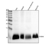 Anti-S100 alpha 6 S100A6 Rabbit Monoclonal Antibody Boster Bio