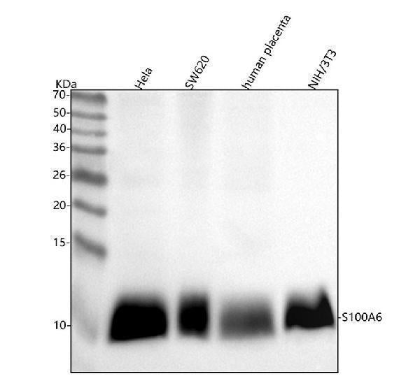 Anti-S100 alpha 6 S100A6 Rabbit Monoclonal Antibody Boster Bio