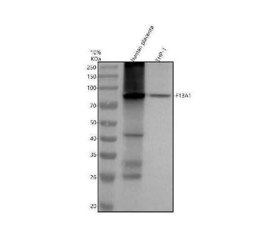 Anti-Factor XIIIa F13A1 Monoclonal Antibody Boster Bio