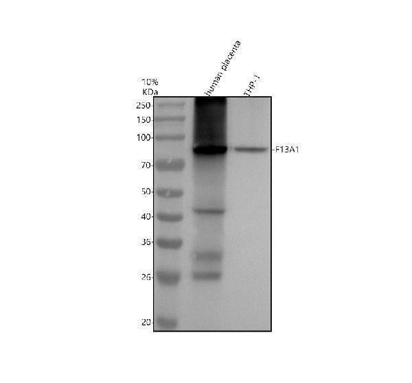 Anti-Factor XIIIa F13A1 Monoclonal Antibody Boster Bio