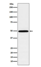 Anti-TIP49A Rabbit Monoclonal Antibody Boster Bio