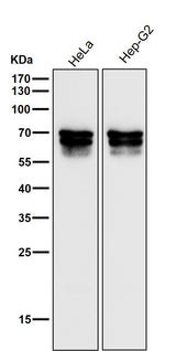 Anti-PICALM Rabbit Monoclonal Antibody Boster Bio