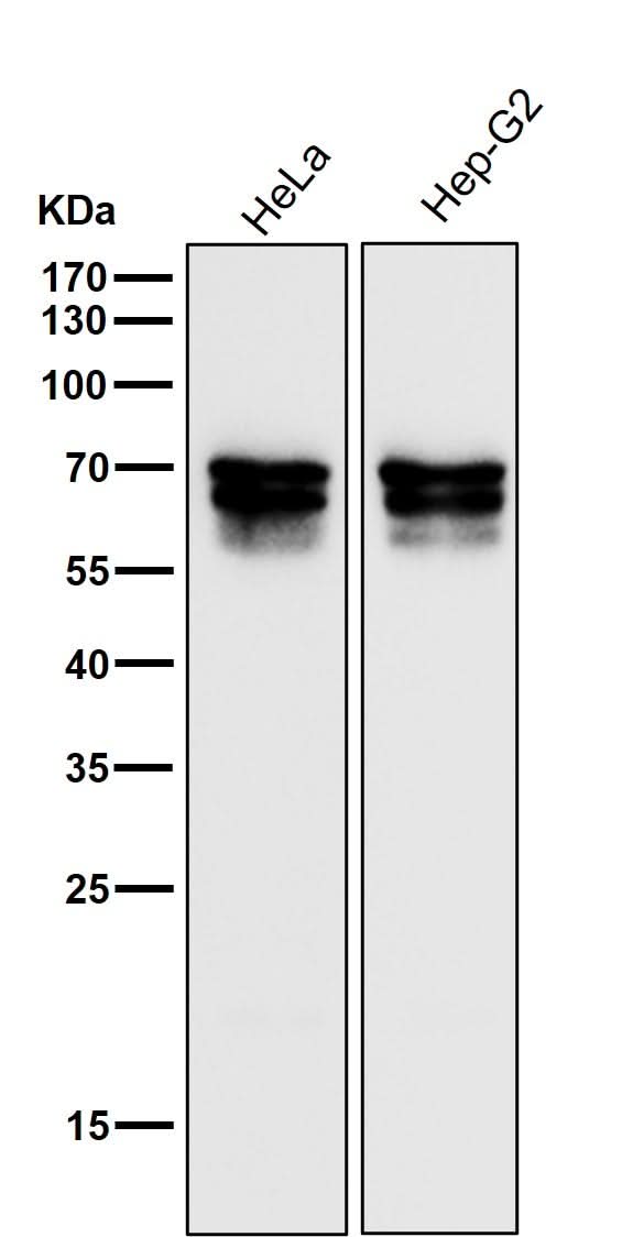 Anti-PICALM Rabbit Monoclonal Antibody Boster Bio