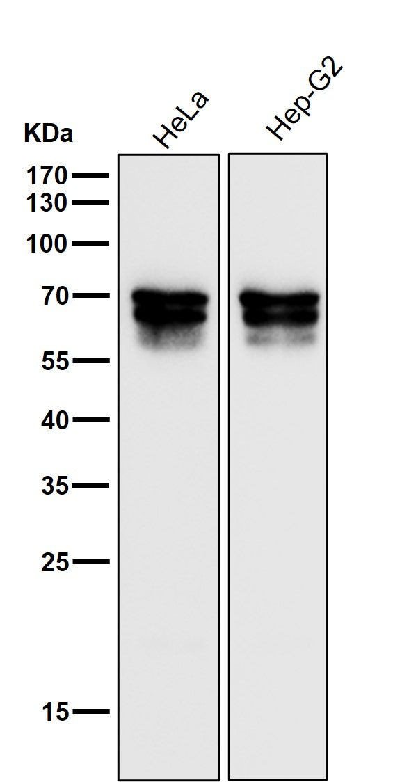 Anti-PICALM Rabbit Monoclonal Antibody Boster Bio