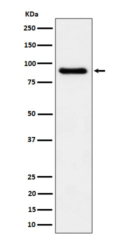 Anti-C1s Rabbit Monoclonal Antibody Boster Bio