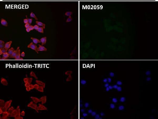 Anti-GPX4 Rabbit Monoclonal Antibody Boster Bio