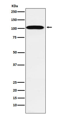 Anti-ATP1A2 Rabbit Monoclonal Antibody Boster Bio