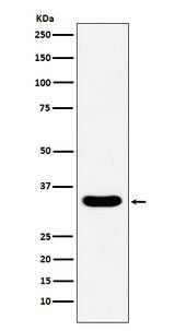 Anti-DAZL Monoclonal Antibody Boster Bio