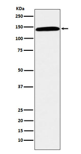 Anti-CD42b Rabbit Monoclonal Antibody Boster Bio