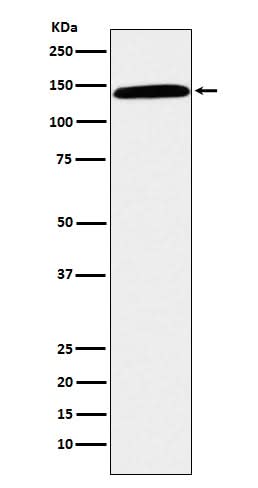 Anti-CD42b Rabbit Monoclonal Antibody Boster Bio