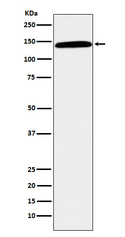Anti-CD42b Rabbit Monoclonal Antibody Boster Bio