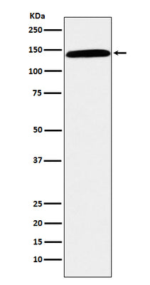 Anti-CD42b Rabbit Monoclonal Antibody Boster Bio