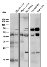 Anti-SMYD3 Monoclonal Antibody Boster Bio