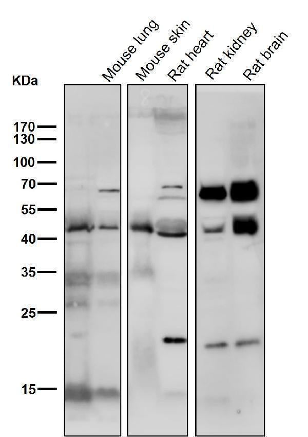 Anti-SMYD3 Monoclonal Antibody Boster Bio