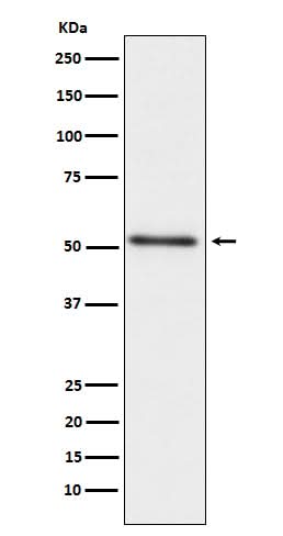 Anti-Prostatic Acid Phosphatase ACPP Monoclonal Antibody Boster Bio
