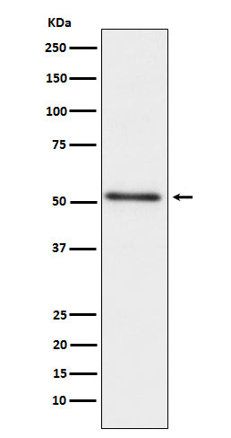 Anti-Prostatic Acid Phosphatase ACPP Monoclonal Antibody Boster Bio