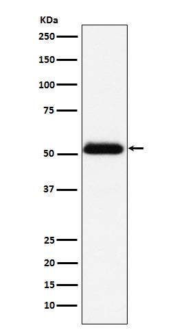 Anti-Prostatic Acid Phosphatase Rabbit Monoclonal Antibody Boster Bio
