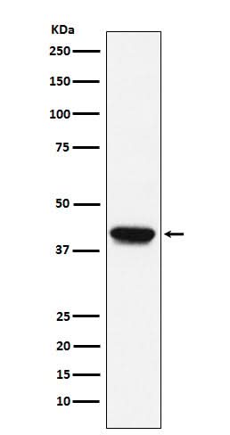 Anti-Biglycan Monoclonal Antibody Boster Bio