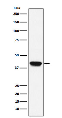 Anti-Biglycan Monoclonal Antibody Boster Bio