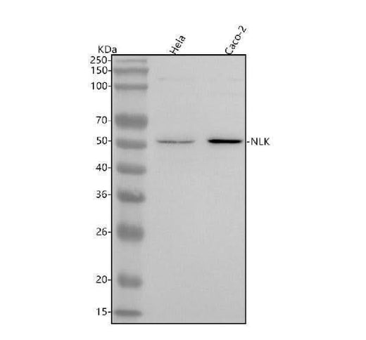 Anti-NLK Rabbit Monoclonal Antibody Boster Bio