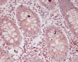 Anti-p16 ARC ARPC5 Rabbit Monoclonal Antibody Boster Bio