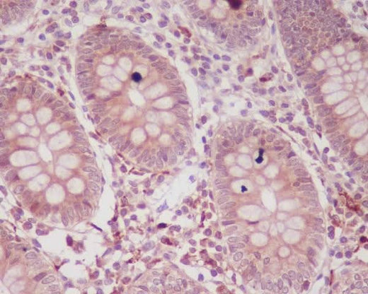 Anti-p16 ARC ARPC5 Rabbit Monoclonal Antibody Boster Bio