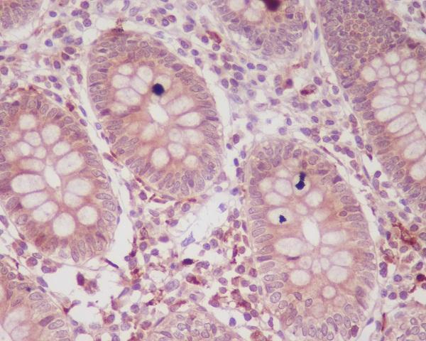 Anti-p16 ARC ARPC5 Rabbit Monoclonal Antibody Boster Bio