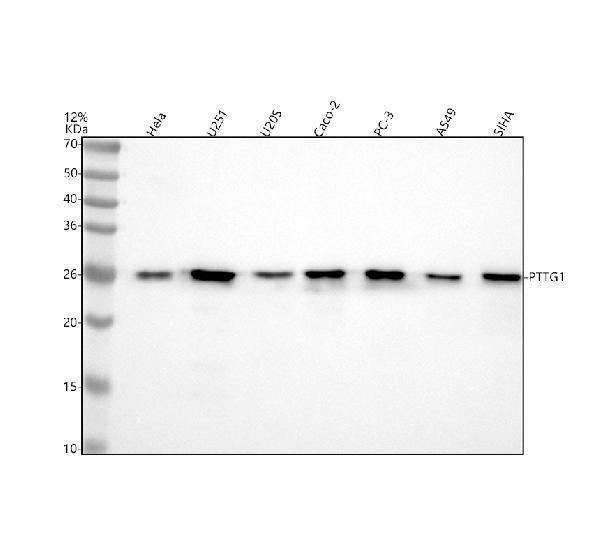 Anti-Securin Monoclonal Antibody Boster Bio