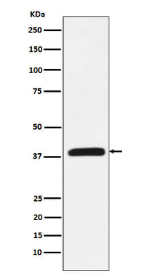Anti-CRKL Rabbit Monoclonal Antibody Boster Bio
