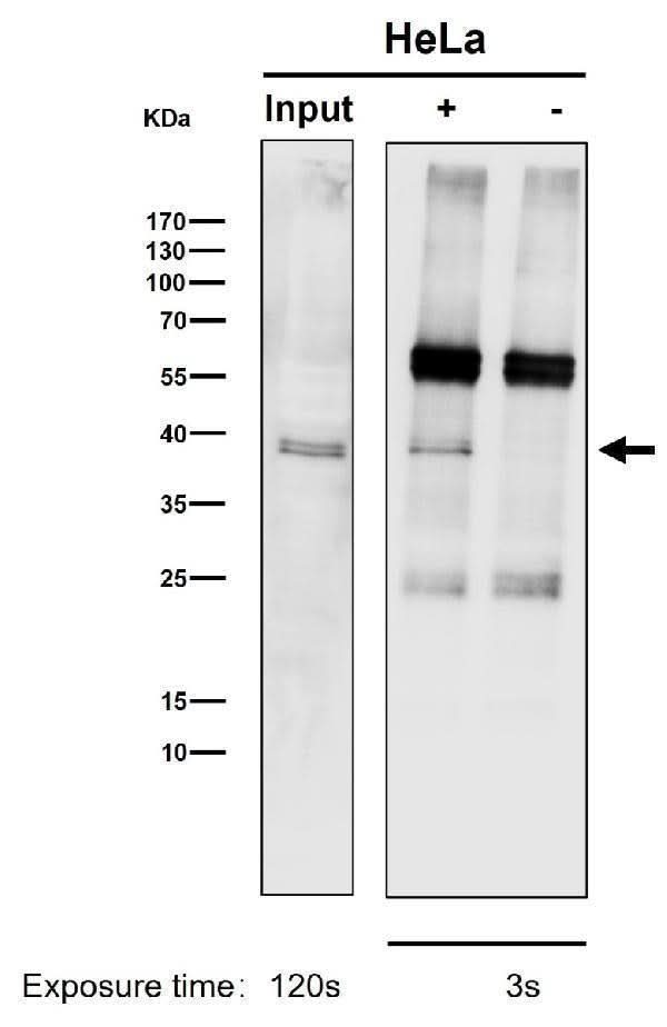 Anti-CrkL Rabbit Monoclonal Antibody Boster Bio