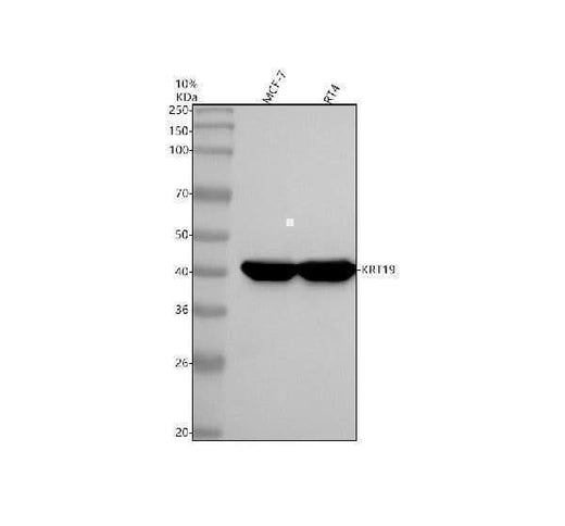 Anti-Cytokeratin 19 Rabbit Monoclonal Antibody Boster Bio
