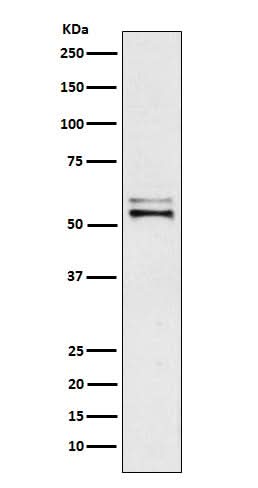 Anti-Angiotensinogen Rabbit Monoclonal Antibody Boster Bio