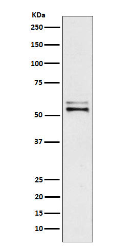Anti-Angiotensinogen Rabbit Monoclonal Antibody Boster Bio