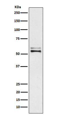 Anti-Angiotensinogen Rabbit Monoclonal Antibody Boster Bio