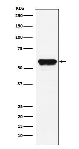 Anti-Angiotensinogen Rabbit Monoclonal Antibody Boster Bio