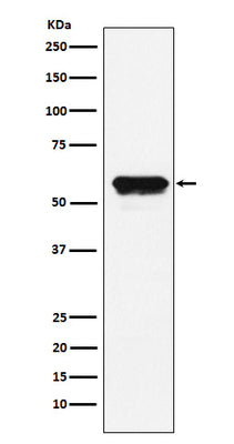 Anti-Angiotensinogen Rabbit Monoclonal Antibody Boster Bio