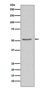 Anti-Angiotensinogen AGT Rabbit Monoclonal Antibody Boster Bio