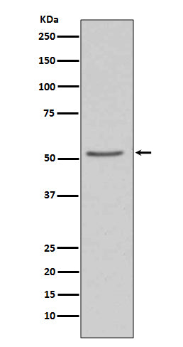 Anti-Angiotensinogen AGT Rabbit Monoclonal Antibody Boster Bio