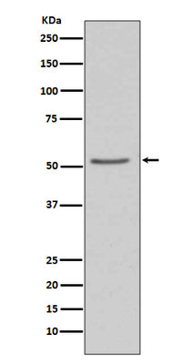 Anti-Angiotensinogen AGT Rabbit Monoclonal Antibody Boster Bio